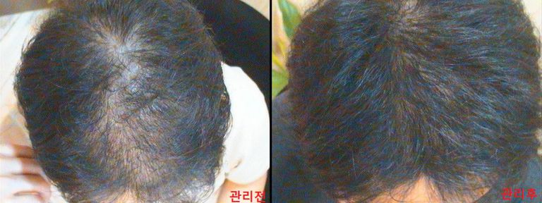 임상사진